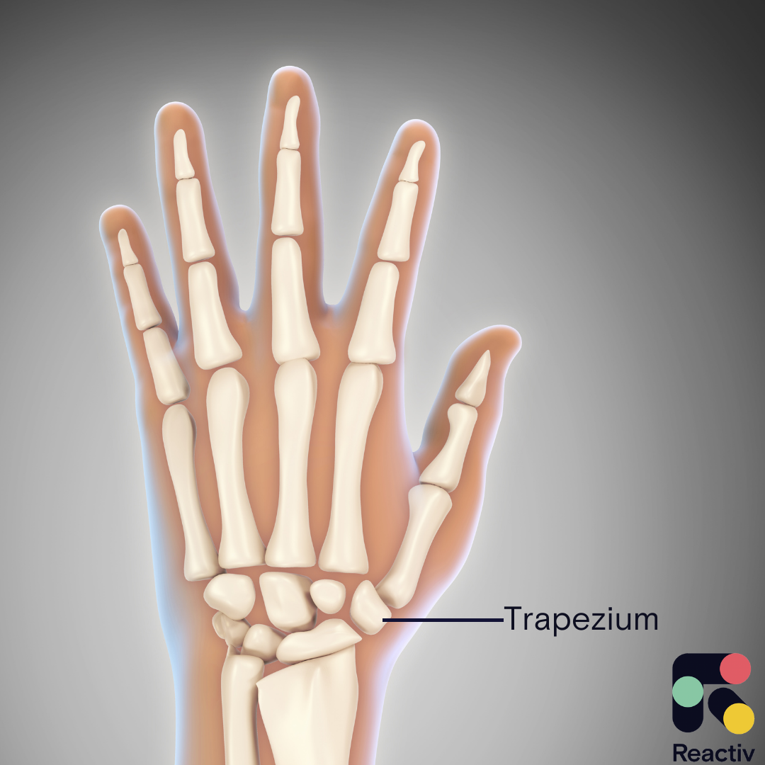Surgery for thumb arthritis: Trapeziectomy