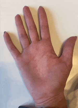 Finger Stiffness Exercises: Make a Fist